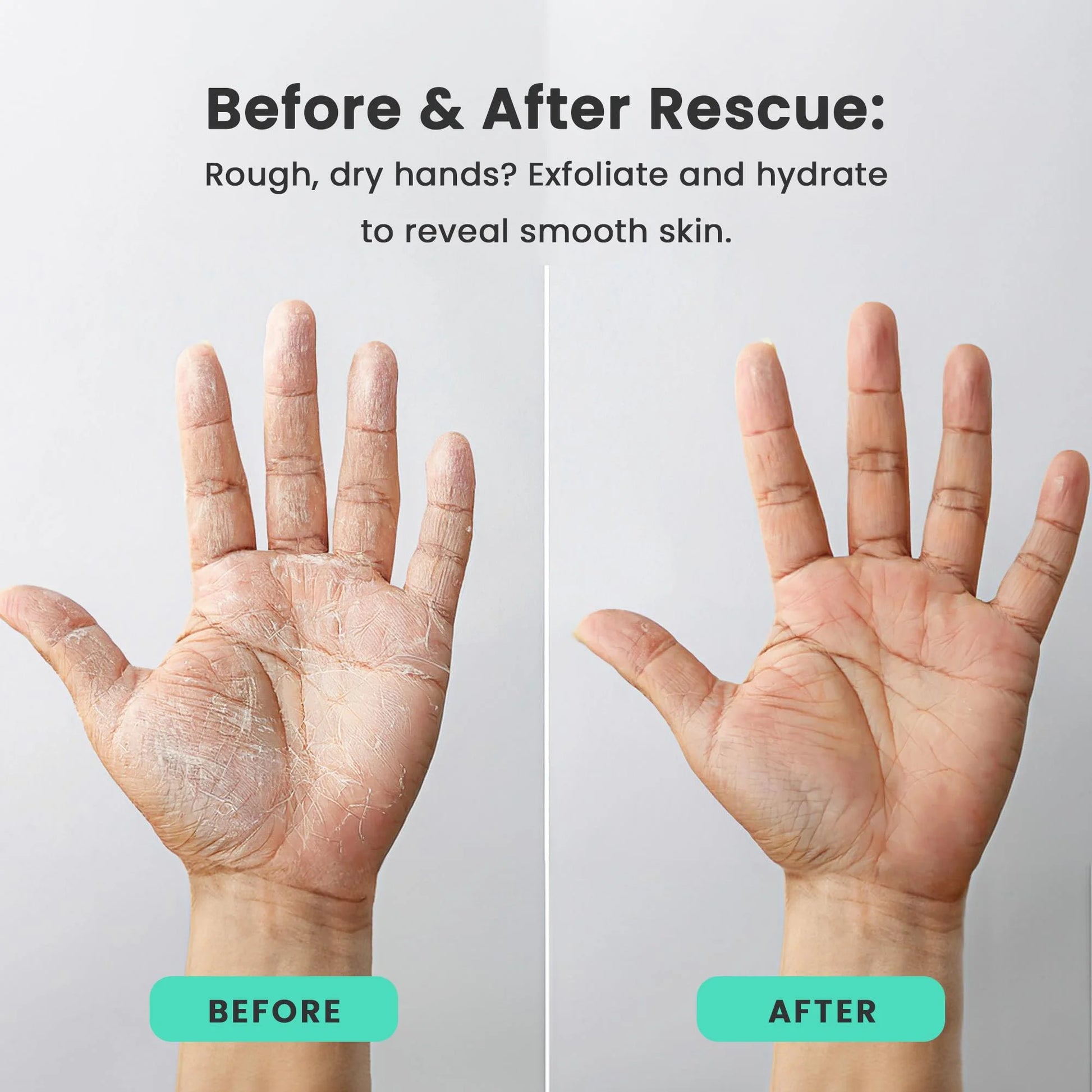 Day and Night Therapeutic Hand Cream for Dry, Cracked Hands - AM Lightweight Moisturizing Exfoliator & PM Overnight Renewal Lotion Softening Hydrating Treatment Unscented - Pack of 2